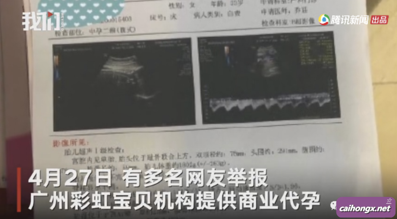 广州机构疑为男同性恋群体代孕被举报 卫健部门已介入 代孕,男同性恋