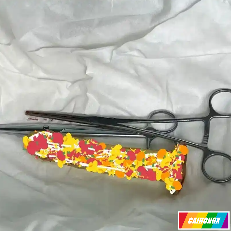 深圳中年男称“不慎坐到”假阳具滑入肛门，硬拖3天致肠道穿孔 